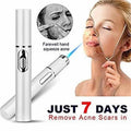 Blue Light Acne Treatment Pen – Targeted Skin Care Device - GluxeHaus