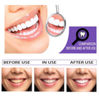 Teeth Whitening Toothpaste – Brighten & Remove Stains - GluxeHaus