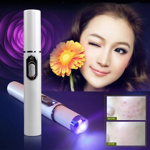 Blue Light Acne Treatment Pen – Targeted Skin Care Device - GluxeHaus