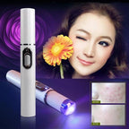 Blue Light Acne Treatment Pen – Targeted Skin Care Device - GluxeHaus