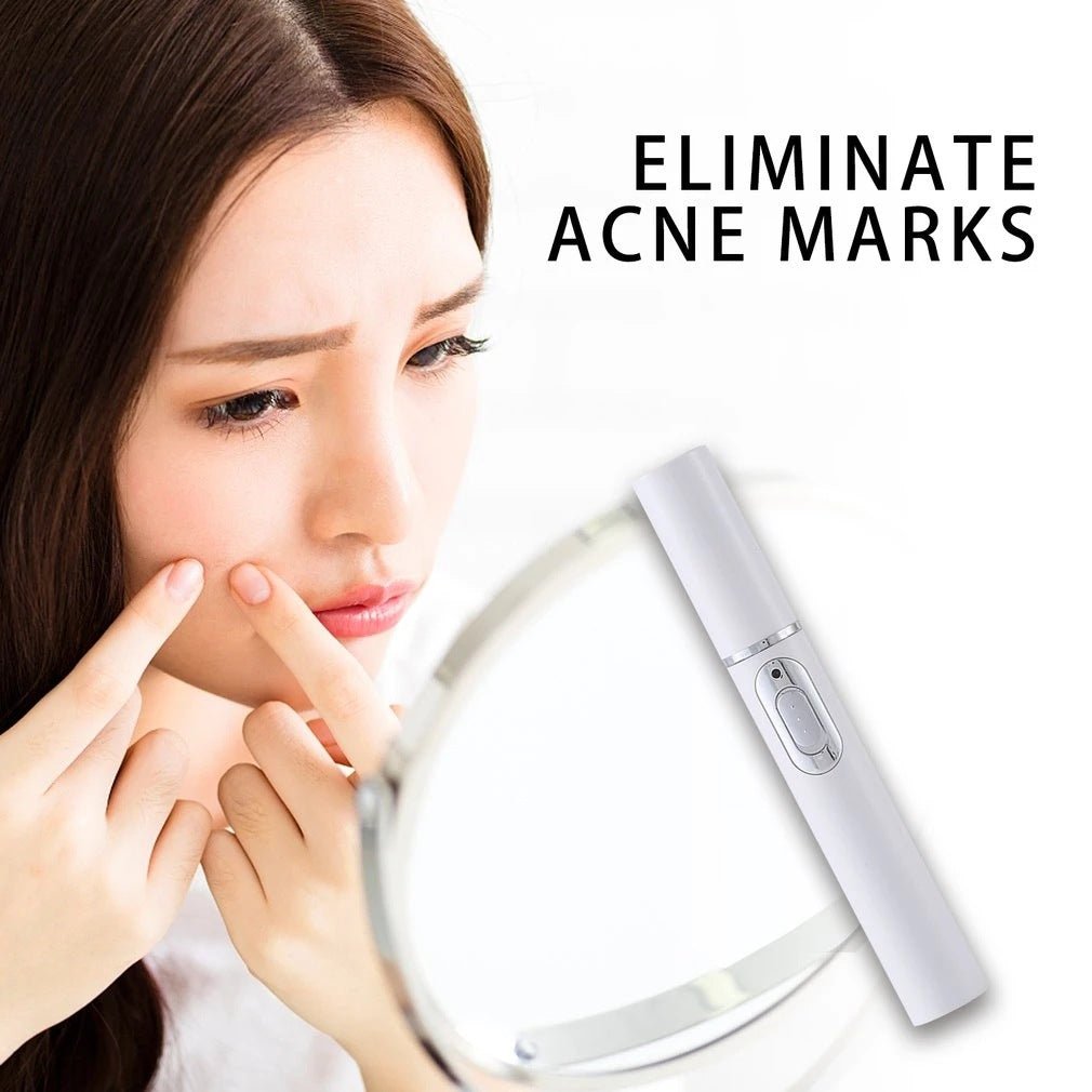 Blue Light Acne Treatment Pen – Targeted Skin Care Device - GluxeHaus