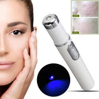 Blue Light Acne Treatment Pen – Targeted Skin Care Device - GluxeHaus