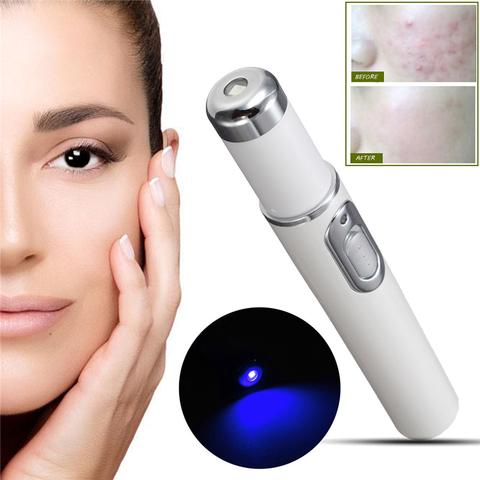 Blue Light Acne Treatment Pen – Targeted Skin Care Device - GluxeHaus