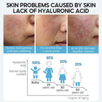 Hyaluronic Acid Face Serum – Hydrate & Smooth Skin - GluxeHaus