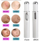 Blue Light Acne Treatment Pen – Targeted Skin Care Device - GluxeHaus